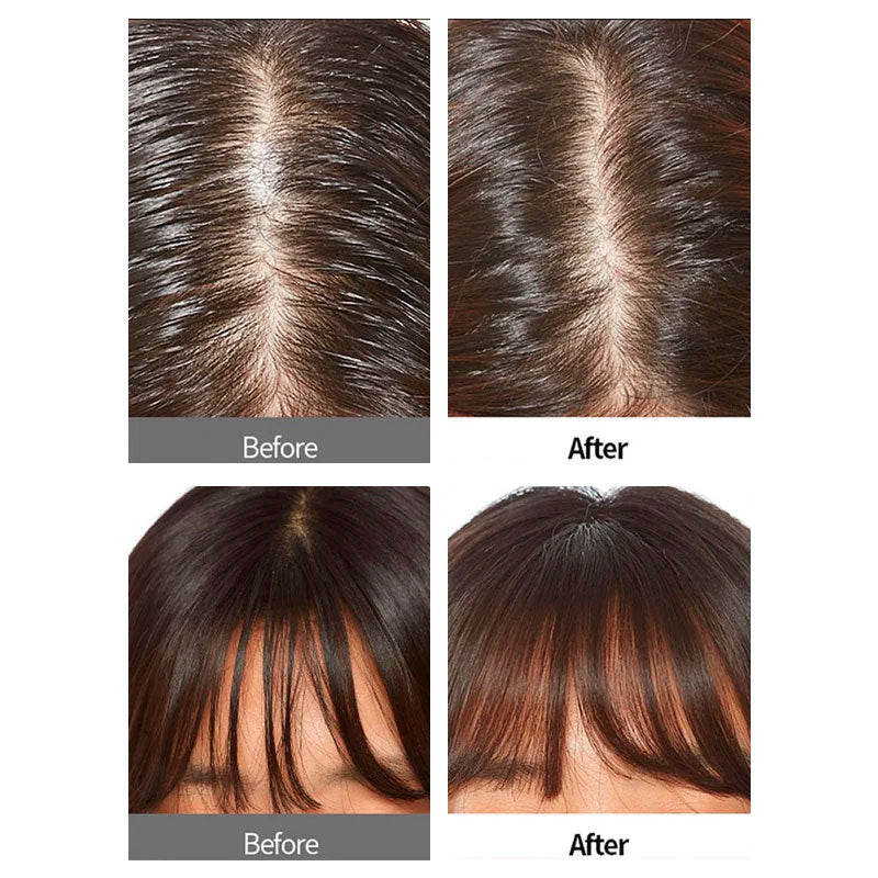 APIEU Oily Hair Dry Powder 5g